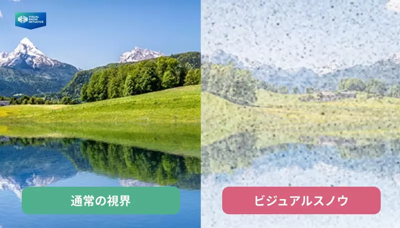 《画师罹患「视雪症」》眼前闪个不停无法画画了分享症状希望大家认识这个可怕的疾病